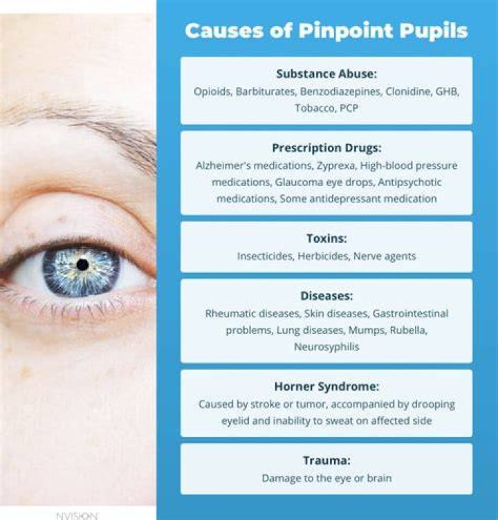 Are pinpoint pupils bad?