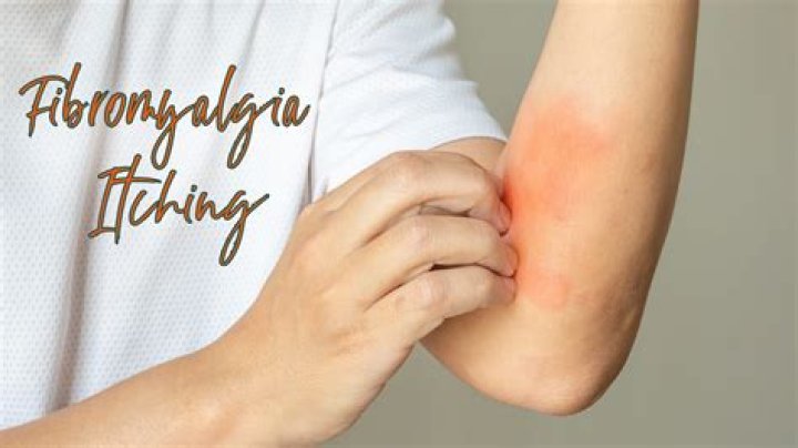 Can fibromyalgia cause itching?