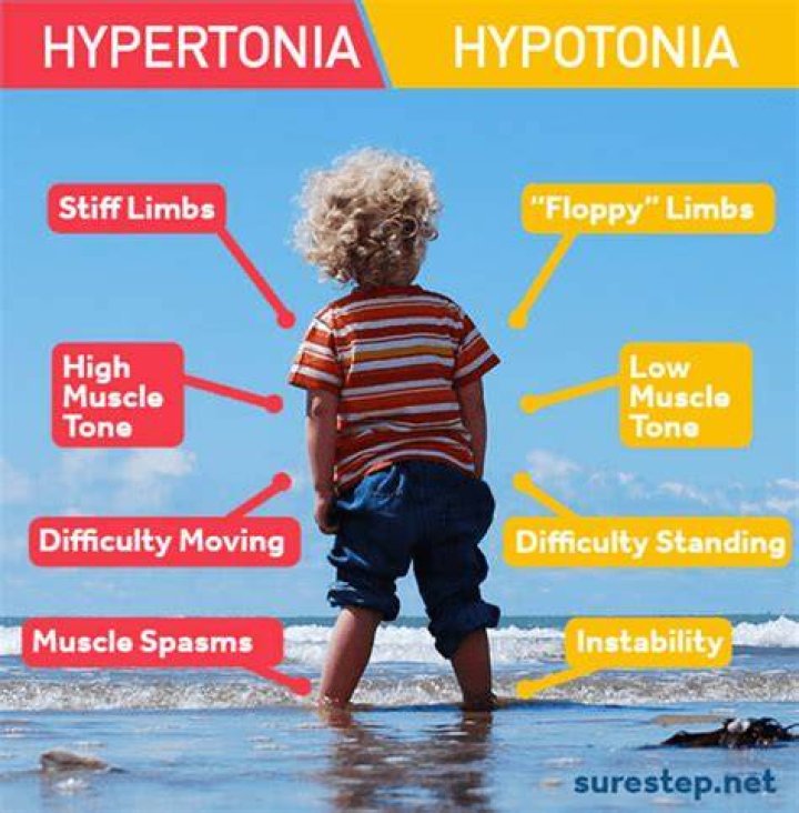 Can hypertonia be cured?