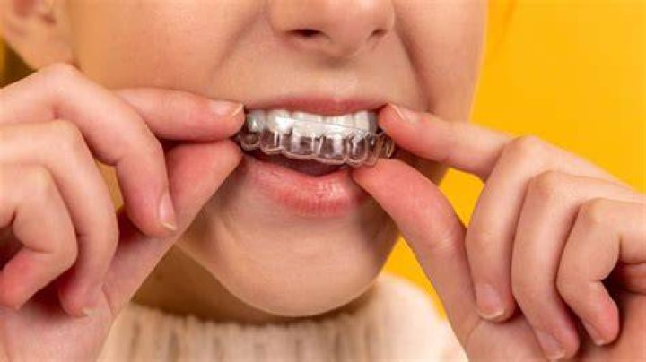 Can i drink beer with aligners?