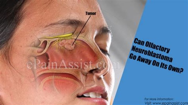 Can neuroblastoma go away on its own?