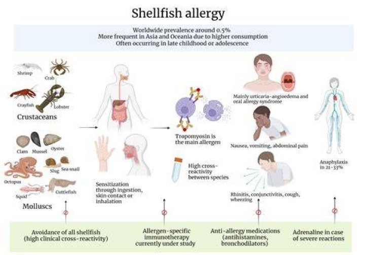 Could i be allergic to shellfish?