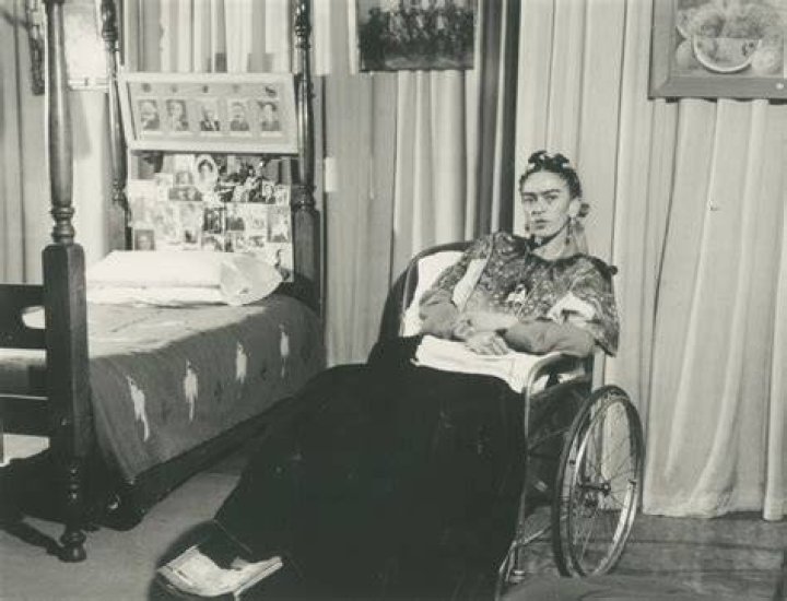 Did frida kahlo have polio?