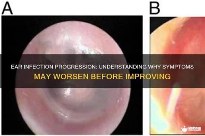 Do infections get worse before better?