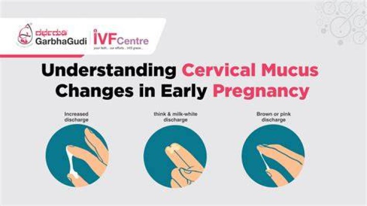 During pregnancy white discharge is good or bad?