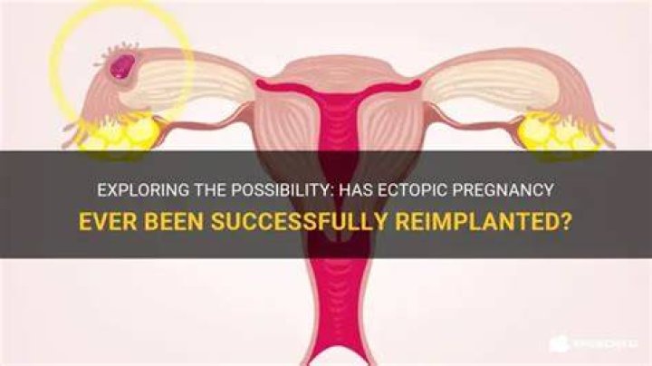 Has an ectopic pregnancy ever been reimplanted?
