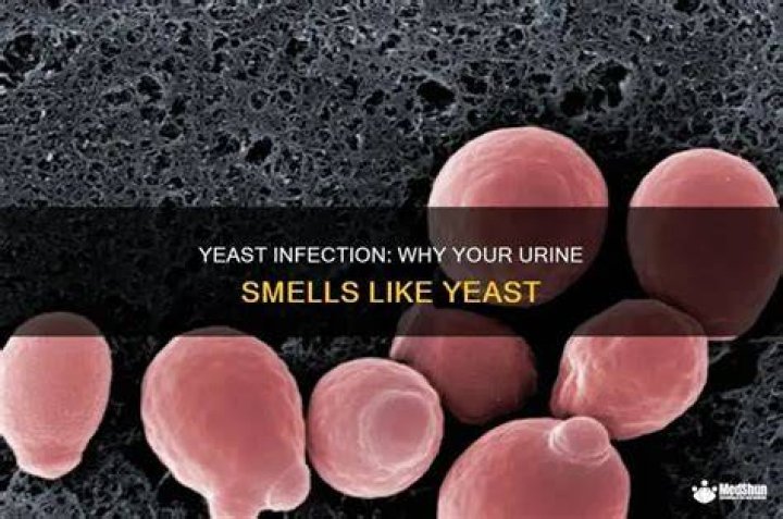How does yeast smell?