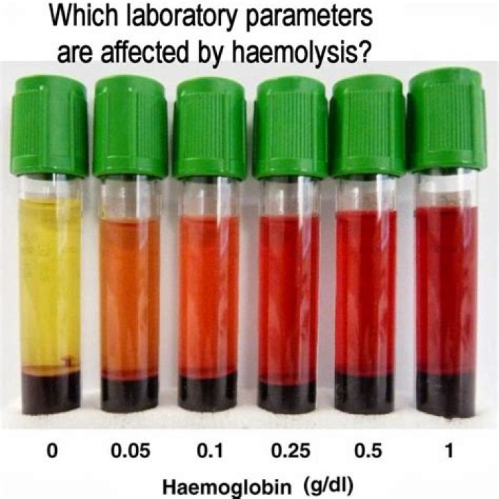 In a hemolyzed specimen?
