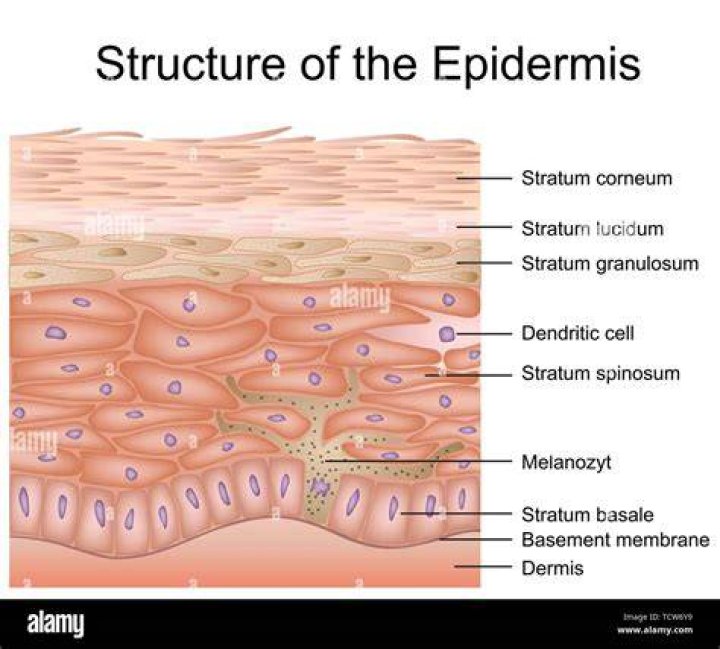 In dermis and epidermis?