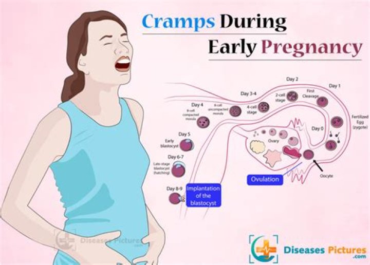 In early pregnancy when does the cramping stop?