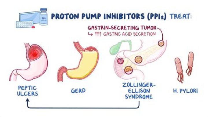 Is a proton pump inhibitor?