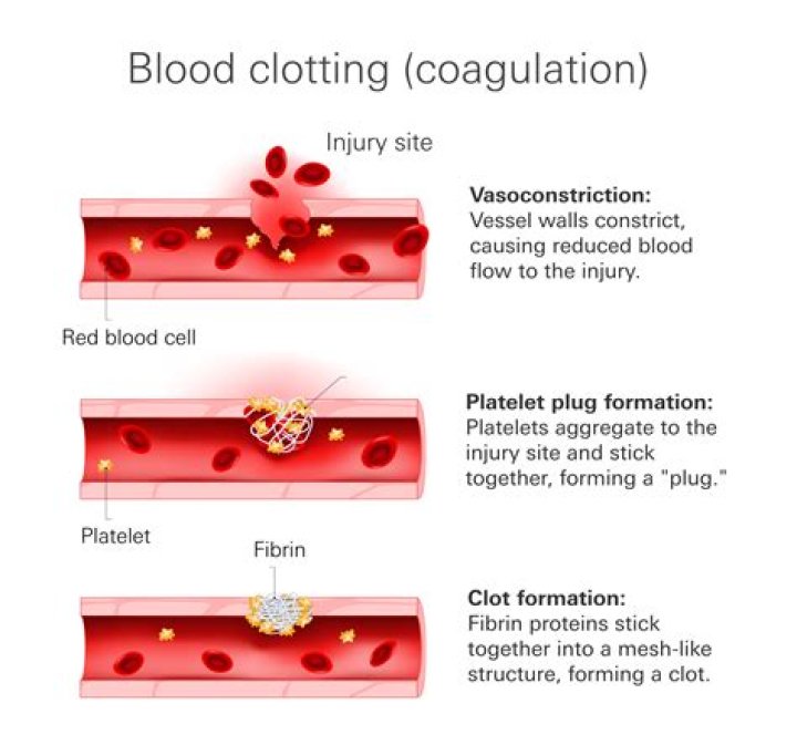 Is blood clotting a blood disorder?