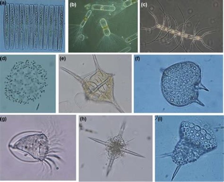 Is diatoms autotrophic or heterotrophic?