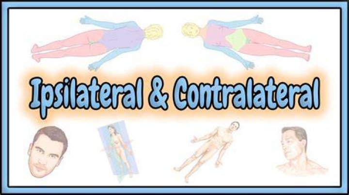 Is ipsilateral a word?