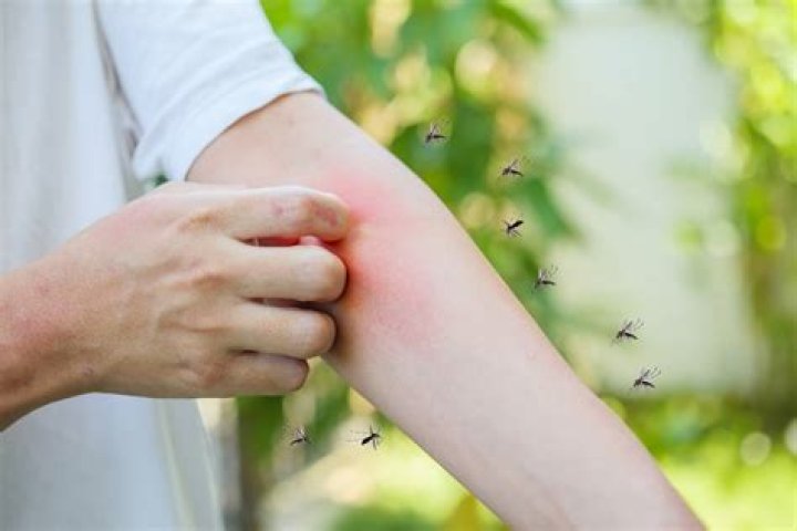 Was bitten by mosquitoes?