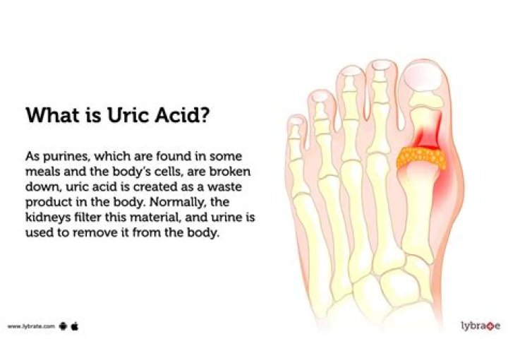 Where does uric acid build up?