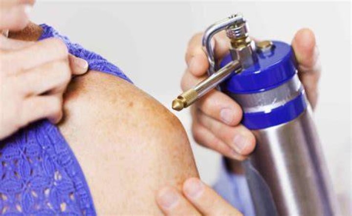 Where is cryosurgery performed?