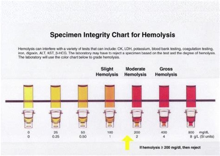 Which specimen is more likely to hemolyzed?