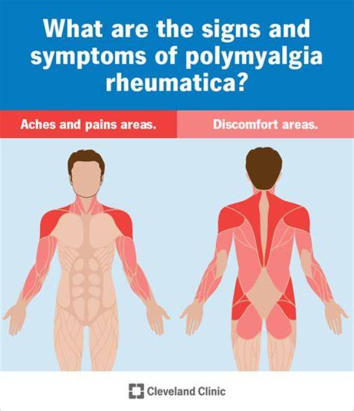 Who can get myalgia?