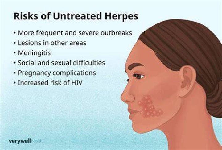 Why are my herpes outbreaks getting worse?
