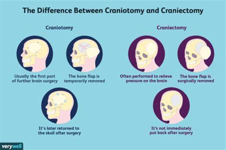 Why have a craniotomy?