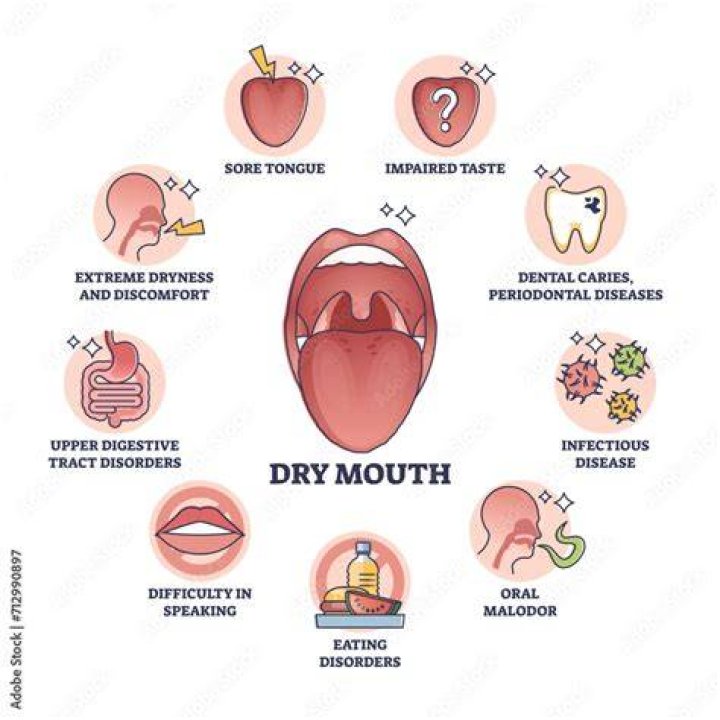 Why you get xerostomia?