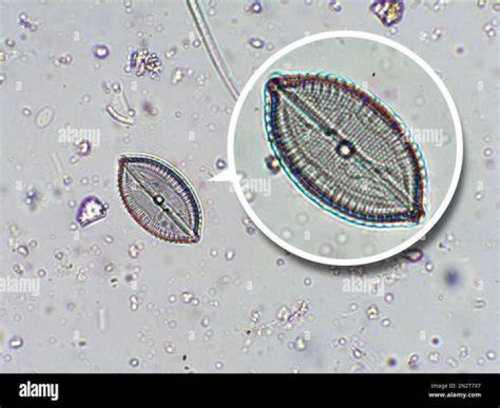 Will diatoms go away?